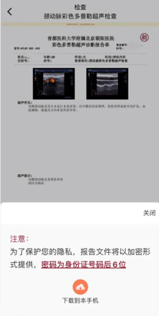 下载报告